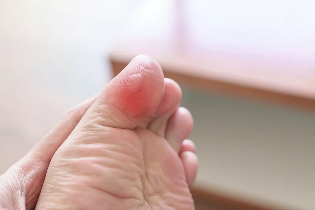 Prevent Blisters and Prolong Shoe Life with Shahrwax Foot and Shoe Care Tips